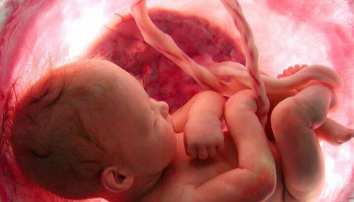 Άμβλωση: πρώτη αιτία θανάτου παγκοσμίως το 2025, κατά τον ΠΟΥ