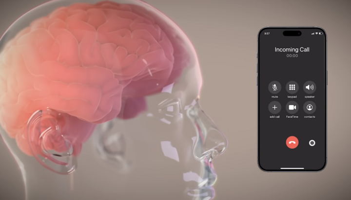Neuralink υπόσχεται συγχώνευση της συνείδησης με την ΤΝ. Фото: Neuralink