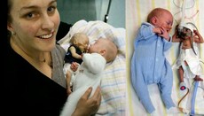 Γονείς απέρριψαν έκτρωση ενός διδύμου τους και τελικά σώθηκαν και τα δύο!